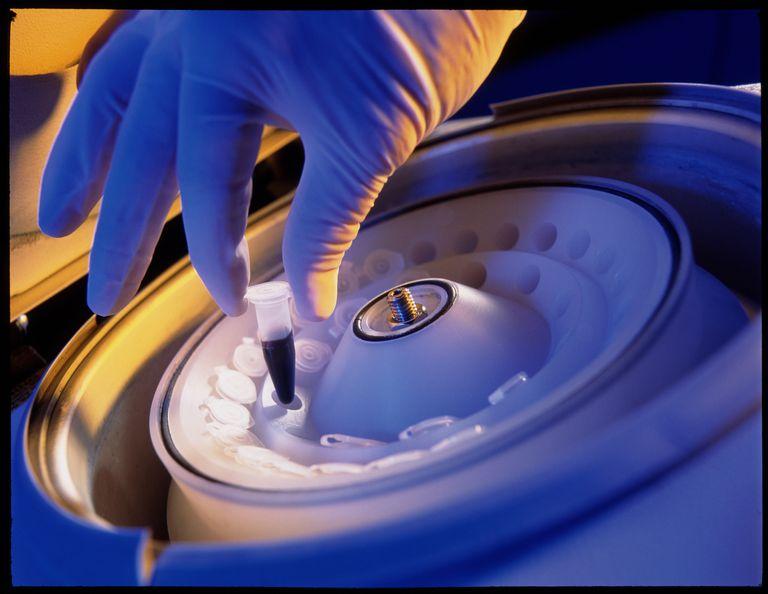 How to choose the right centrifuge configuration for your laboratory